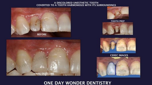 One Day Wonder Dentistry